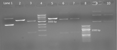 Photo of an electrophoresis gel with several ladders of bright lines.