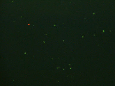 Photo of a few scattered bright green dots and one red dot on a very dark green background.(left) Photo showing two clusters of bright green dots (8 dots in one cluster, 3 dots in the other).(right)