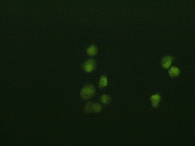 Photo of a few scattered bright green dots and one red dot on a very dark green background.(left) Photo showing two clusters of bright green dots (8 dots in one cluster, 3 dots in the other).(right)