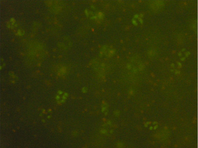 Photo of a few scattered bright green dots and one red dot on a very dark green background.