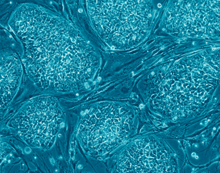 Photo of human embryonic stem cells stained blue