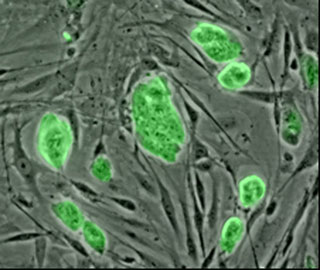 Mouse embryonic stem cells marked in fluorescent green, viewed under a microscope